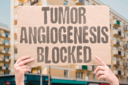 "Tumor Angiogenesis Blocked" Prevent formation of new blood vessels to the mass. VASCULAR. VEGF. INHIBITION. STARVATION. HYPOXIA.