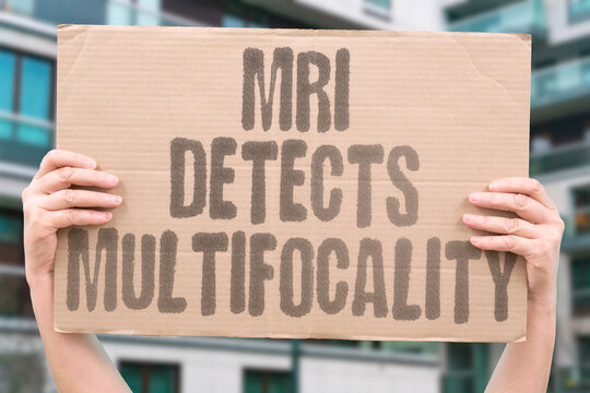 "MRI Detects Multifocality" Identify additional lesions beyond the primary tumor. MULTIFOCAL. MULTICENTRIC. STAGING. PLANNING. MRI.