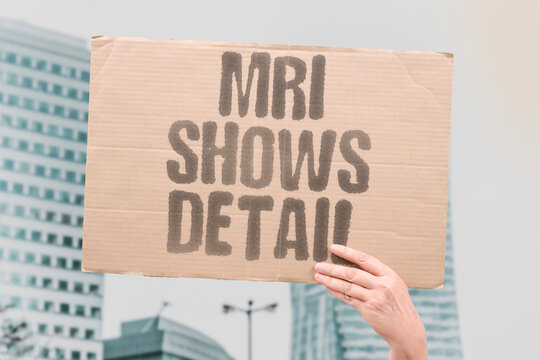 "MRI Shows Detail" Magnetic resonance provides high-resolution tissue images. RESOLUTION. ANATOMY. CONTRAST. MULTIPLANAR. CHARACTERIZATION.