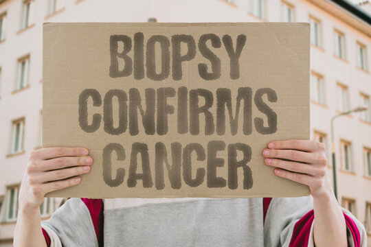 "Biopsy Confirms Cancer" Tissue analysis establishes the diagnosis definitively. PATHOLOGY. HISTOLOGY. DIAGNOSIS. TISSUE. MARKER.