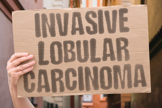 "Invasive Lobular Carcinoma" A distinct subtype with unique growth characteristics. SUBTYPE. LOBULAR. INVASIVE. HISTOLOGY. STAGING.