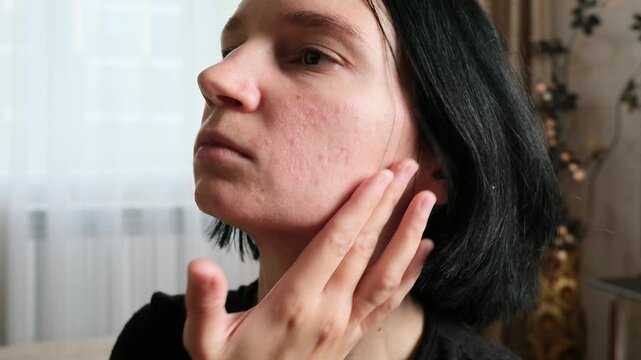 Clinical Skin Care Treatment With Healthy Glowing Skin