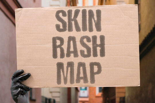 "Skin Rash Map" Chart where and when skin reactions occur. RASH. LOCATION. TIMING. TRIGGER. REACTION.