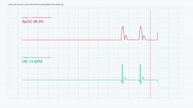 Capillary Blood Flow Photoplethysmogram PPG Monitor Display, Synchronous Medical ECG Pulse Waveform Telemetry, High Key Laboratory Screen Loop 60fps
