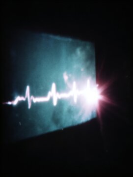 Extreme close-up of a hospital patient monitor displaying a flatline ECG with subtle static, analog noise, soft bloom, and cold glow, minimal cinematic composition