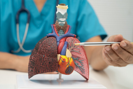 Pneumonia, lung cancer, Asian doctor holding human model.