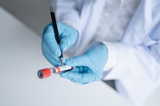 Female medical laboratory technician holding blood sample tube for laboratory testing at clinical laboratory.
