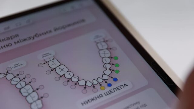 White stylus in right hand touching dental chart on tablet screen, marking colored tooth arch icons inside clinical closeup with clean interface, soft light, medical focus, detailed view