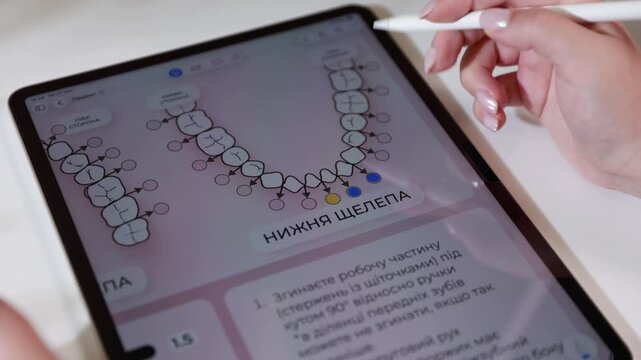Hand using white stylus on tablet with dental chart, colored markers and schematic icons in clinical workspace, showing digital planning interface for healthcare consultation