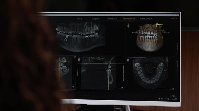 Dental clinic monitor showing panoramic xray, 3D skull render and sectional ct slices with measurement overlays during consultation, with dental, monitor, xray, teeth detail