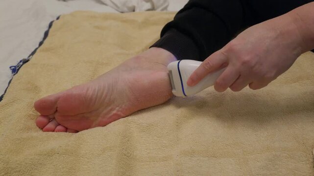 Person using handheld electrostatic pilling removal device on beige textile, demonstrating fabric care technique with original sound included.