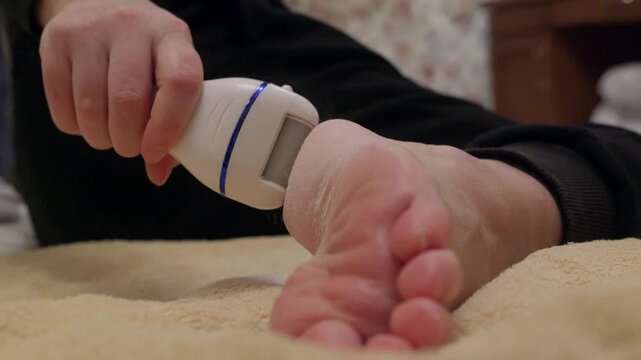 Close up of parent applying electric pilling tool to baby foot, capturing gentle skincare treatment with authentic device audio, natural sound recording included.