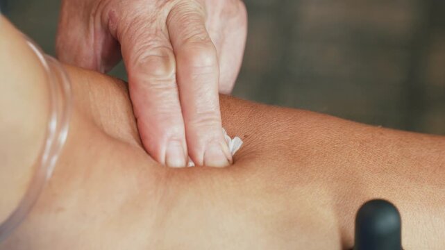 Removing Needle After Venous Blood Collection at Home