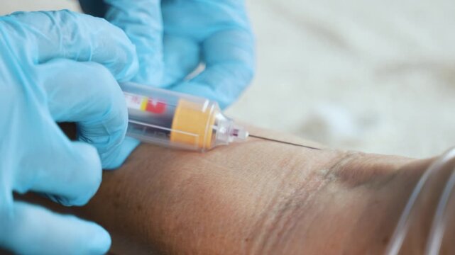 Venous Blood Collection Using Vacuum Tube During Home Visit