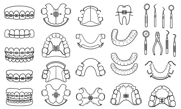 Detailed vector illustration set showing various orthodontic tools and dental braces. Includes appliances, aligners, and dental instruments to represent orthodontic care. 