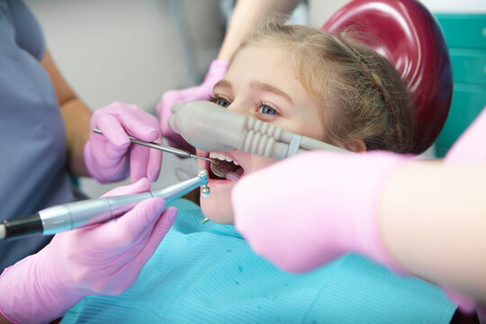 Little girl with sedation mask. Treatment of children's teeth with nitrous oxide. Children's dentistry. Anesthesia for children in dental treatment.