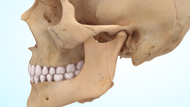 Mandible or Jaw bone fracture of 3d illustration