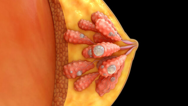 Fibrocystic breast lobules of 3d illustration