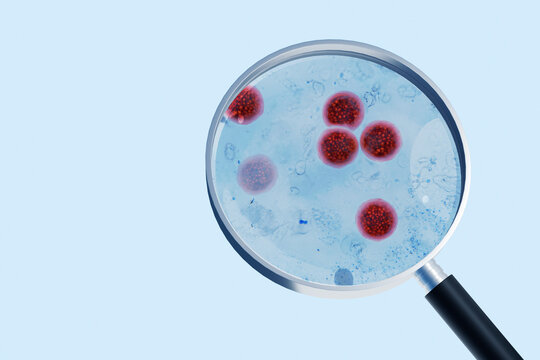 Cyclospora cayetanensis parasites viewed through a magnifying glass. 3D microscopic concept of a cyclosporiasis outbreak, foodborne infection, laboratory diagnostics. water pollution concept