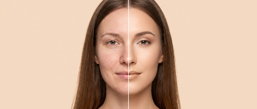  Beauty comparison portrait of a woman's face before and after makeup. Split face concept showing natural bare skin with imperfections versus flawless nude makeup on a light beige background