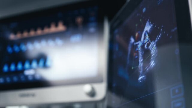 Ultrasound monitor displays a moving image of the heart during surgery. Doctors assess and monitor the patient&rsquo;s cardiac function in the operating room.