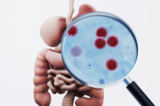 Cyclosporiasis infection concept. Magnifying glass showing Cyclospora cayetanensis parasites in the human digestive system, stomach, and intestines. Medical 3D render of a foodborne outbreak.