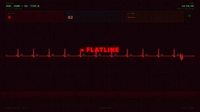 Ecg Heart Monitor Flatline Cardiac Rhythm Vital Signs Screen Loop