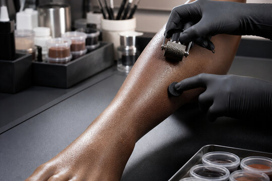 Close-up of a gloved skincare professional using a derma roller during a cosmetic treatment on a clients leg in a modern clinic.
