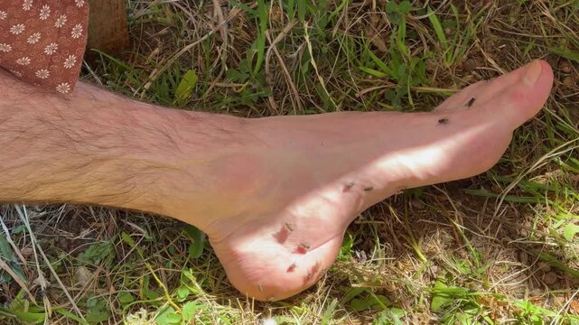 Ants biting human foot and leg
