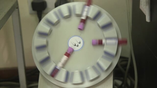 Hospital laboratory equipment with blood sample tubes arranged in a circular analyzer inside a medical lab.