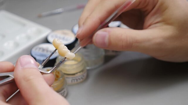 Dental technician hands applying ceramic glaze to prosthetic bridge using tongs and fine brush. Background reveals glass jars with various staining pigments. Professional dental laboratory coloring 