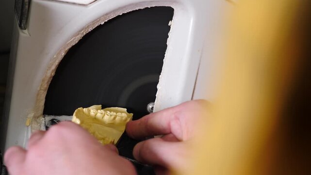 Dental technician hands removing excess material from plaster jaw model. prosthetic dental lab work, precise manual craftsmanship, shaping process, and detailed dental restoration manufacture. 4k 