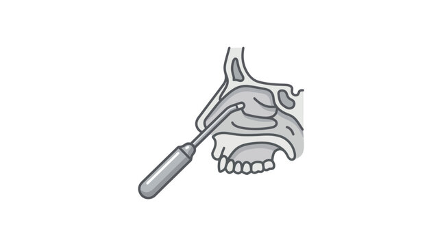 Nasal cavity medical procedure with surgical tool.