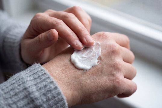 Closeup of white cream being applied onto the back of a bare hand