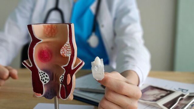 Proctologist doctor inserting rectal suppository into artificial model of human rectum