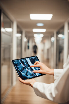 Doctor analyzes CT images with AI on tablet in hospital corridor