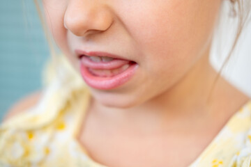 Obraz premium close up little girl mouth and teeth, funny facial expression, kids dental health, pediatric dentistry care, showing teeth and tongue during playful moment, cute child portrait, emotions and feelings