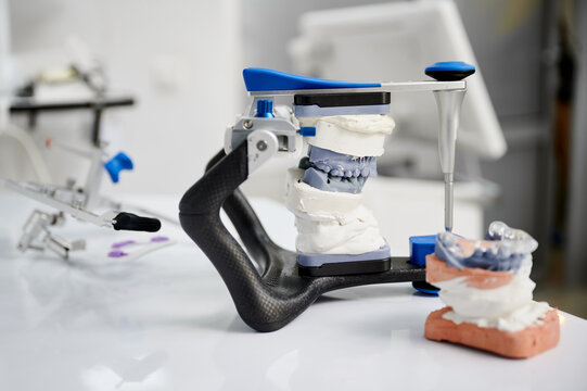 Dental articulator with jaw casts and occlusal splint on clinic table. Gnathological treatment planning, occlusion analysis and functional dentistry workflow concept