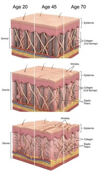 Skin aging timeline cross section demonstrating cellular change at age twenty, forty five and seventy, showing gradual epidermis thinning, broken collagen spring, frayed elastin, deepening wrinkle.