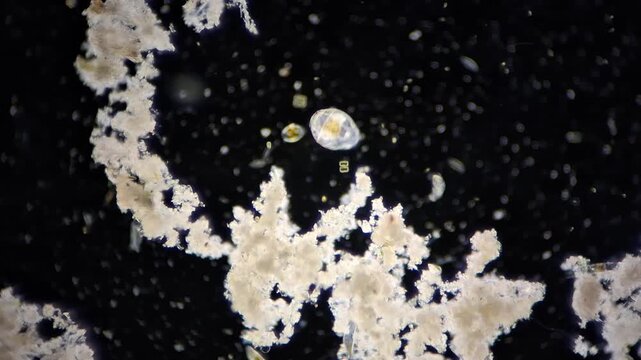 Rotifer under microscope with darkfield illumination, freshwater microorganism with lorica and foot 