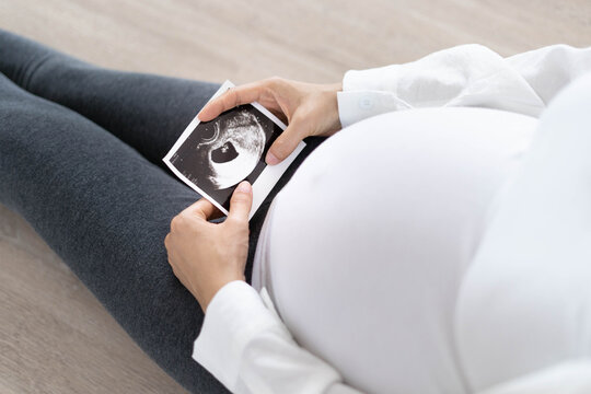 pregnant woman holding ultrasound scan. pregnant woman with baby shoes. pregnant woman, Mother gently touches the baby on stomach. Happy, family, growth, pregnancy, enjoyment , prepare newborn.
