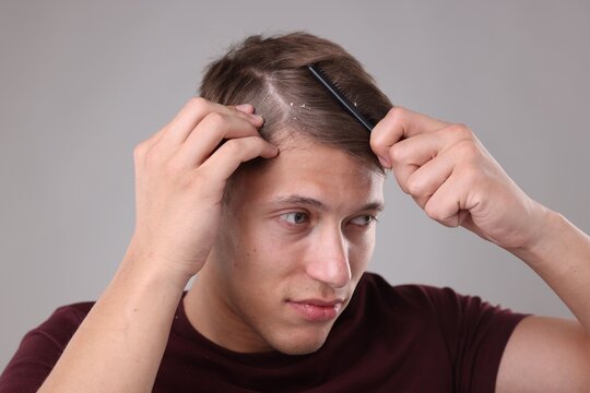 Dandruff problem. Man combing his hair on grey background