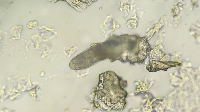 Close up view of demodex mite under laboratory microscope