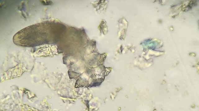 Close up view of demodex mite under laboratory microscope