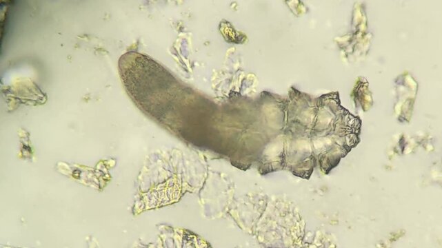 Close up view of demodex mite under laboratory microscope