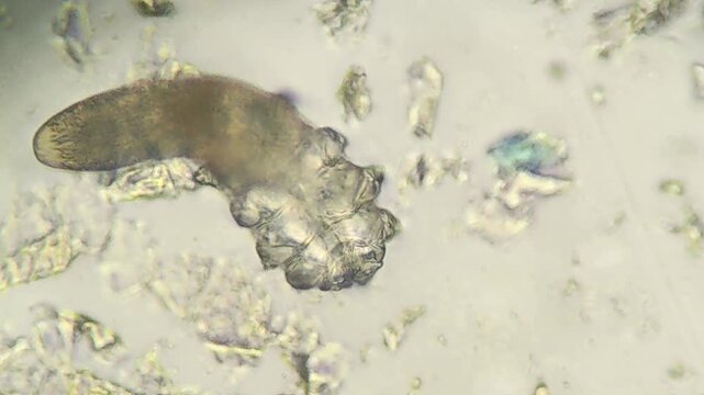 Close up view of demodex mite under laboratory microscope
