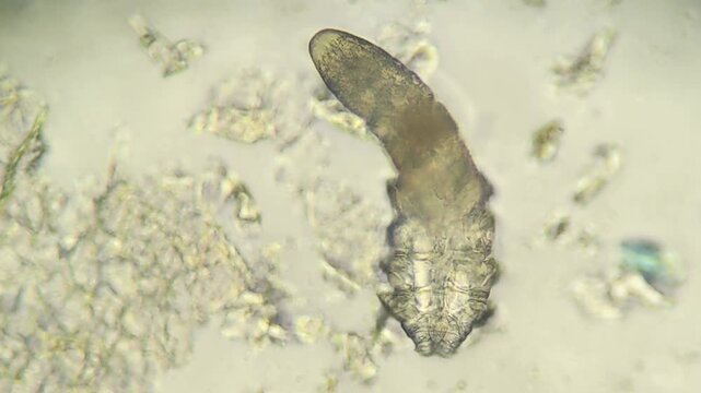 Close up view of demodex mite under laboratory microscope