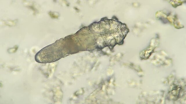 Demodex mite parasite visible under microscope magnification