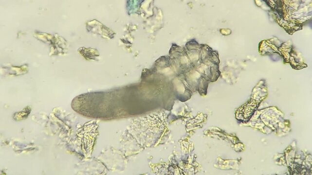 Demodex mite parasite visible under microscope magnification