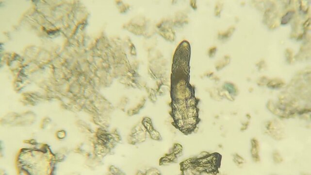 Demodex mite parasite visible under microscope magnification